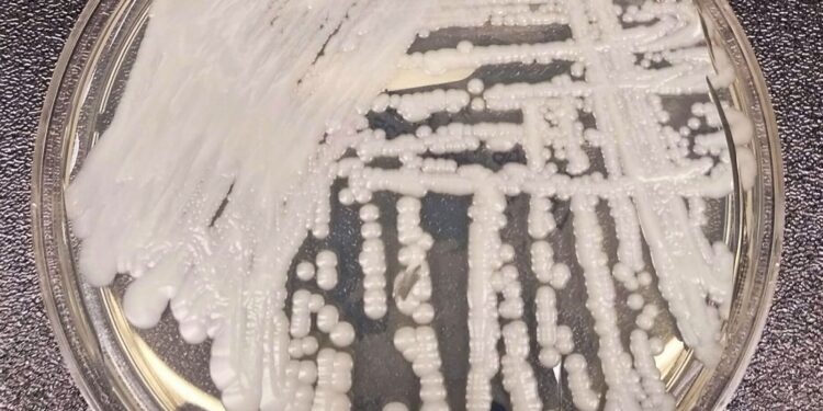 fiocruz-e-pasteur-vao-pesquisar-sobre-danos-dos-fungos-no-ser-humano