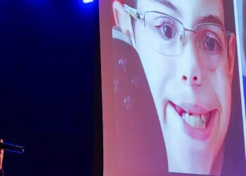 dia-de-conscientizacao-busca-informar-populacao-sobre-o-labio-leporino